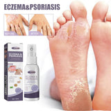 Hand And Foot Care Spray Relieves Dry Skin
