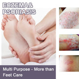 Hand And Foot Care Spray Relieves Dry Skin