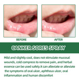 Breath Cleaning Odor Oral Care Spray