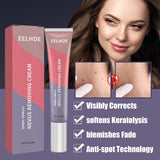 Skin Cleaning Removal Mole Wart Skin care lotion Hand And Foot