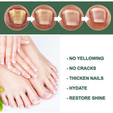 Foot Care Solution Onychomycosis Nail Care Solution