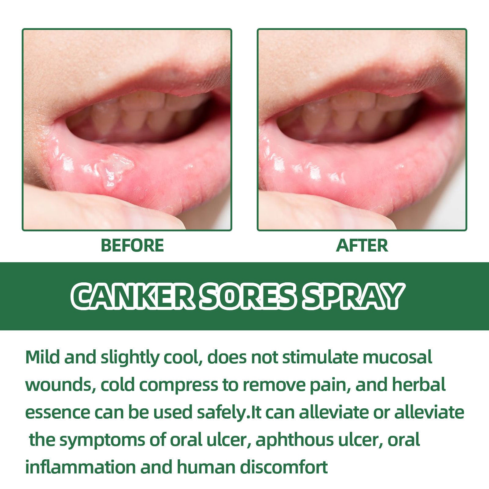 Breath Cleaning Odor Oral Care Spray