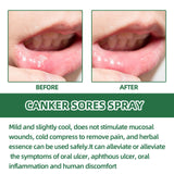 Breath Cleaning Odor Oral Care Spray