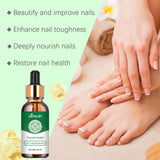 Onychomycosis Repair Essence Hand And Foot Nutrition